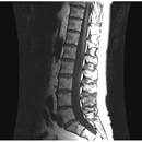 Preguntas de Traumatologia APK
