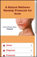 Acne Protocols bài đăng