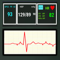 ECG - Polygraph Lie Detector