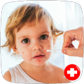 Chickenpox Guide