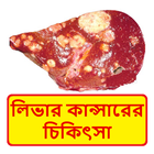 লিভার কান্সার চিকিত্‍সা ~ Liver cancer Treatment icône