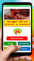 আক্কেল দাঁতের চিকিৎসা ~ Wisdom Teeth Treatment poster