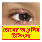 চোখের অঞ্জলির চিকিৎসা ~ Eye Blind Treatment иконка