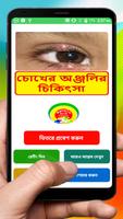 চোখের অঞ্জলির চিকিৎসা ~ Eye Blind Treatment bài đăng