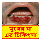 মুখের ভেতর ঘা রোগ এর চিকিৎসা ~ Scurvy disease icon