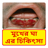 মুখের ভেতর ঘা রোগ এর চিকিৎসা ~ Scurvy disease icône