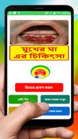 মুখের ভেতর ঘা রোগ এর চিকিৎসা ~ Scurvy disease plakat