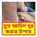 দ্রুত আঁচিল দূর করার উপায় APK