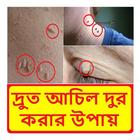 দ্রুত আঁচিল দূর করার উপায় icono