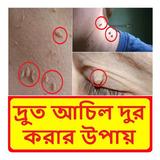দ্রুত আঁচিল দূর করার উপায় icono