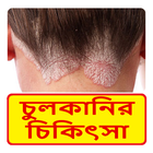 Icona চুলকানির চিকিৎসা ~ The way to prevent itching