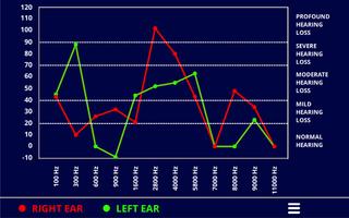 Ear Hearing Test & Audiogram screenshot 3