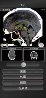 CT 护照测验 "头部" / 剖面解剖/ MRI 截圖 2