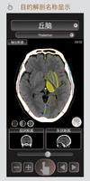 CT 护照 "头部" / 剖面解剖/ MRI 海报
