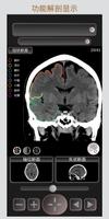 CT 护照 "头部" / 剖面解剖/ MRI 截图 1