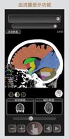 CT 护照 "头部" / 剖面解剖/ MRI 截图 2