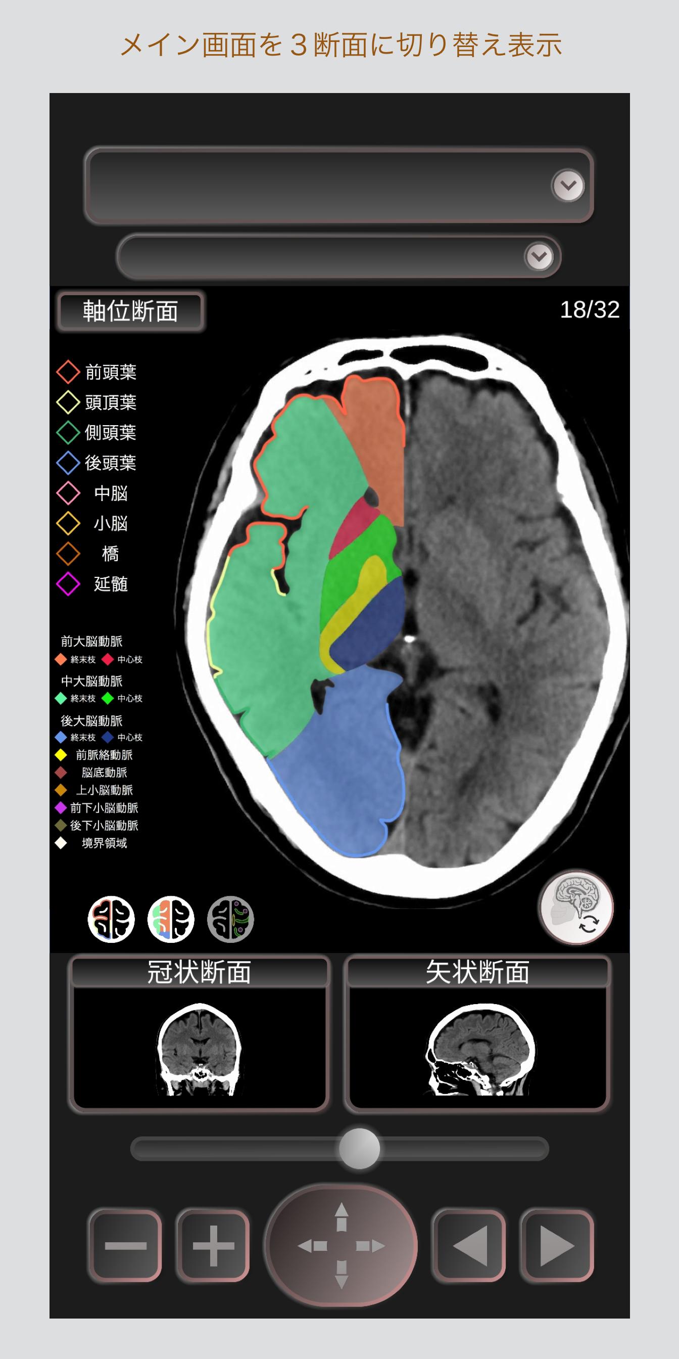 Android 用の Ct Passportlite 頭部 脳 Ct断面図解剖アプリ Mri Apk をダウンロード Android 用の Ct Passportlite 頭部 脳 Ct断面図解剖アプリ Mri Apk をダウンロード