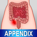 Appendix Diet Foods Help Tips aplikacja