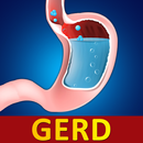 Help for Baby Acid Reflux & GER in Infants APK
