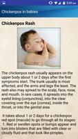 Chicken Pox in Kids Causes Treatment Help capture d'écran 1