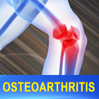 Osteoarthritis Joint Pain Help icône
