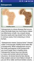 Osteoporosis Weak Bones Diet capture d'écran 1