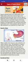 Peptic Ulcers Help & Diet Tips screenshot 2