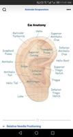 Auricular Acupuncture Microsystems & TCM Diagnosis screenshot 2