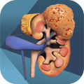 iURO Oncology