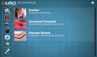 iURO Andrology screenshot 3