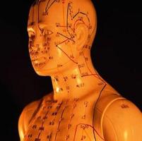 Techniques d'acupuncture Affiche