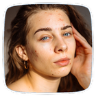 Acne Guide icon