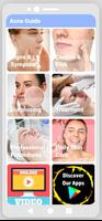 Acne Guide poster