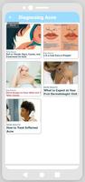 Acne Guide screenshot 3
