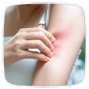 Allergies Guide APK