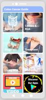 Colon Cancer Guide poster