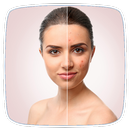 Acne Natural Remedies Tips APK