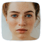Freckles Home Remedies Tips ícone