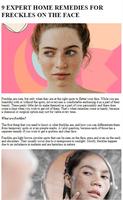 Freckles Home Remedies Tips Affiche