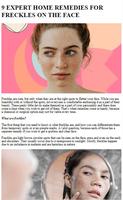 Poster Freckles Home Remedies Tips