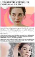 Freckles Home Remedies Tips Cartaz