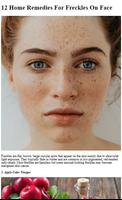 Freckles Home Remedies Tips capture d'écran 1