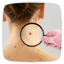 How to Prevent Skin Cancer APK