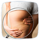 How to Get Rid of Cellulite APK