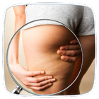 How to Get Rid of Cellulite 图标