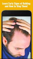 How to Stop Baldness Thinning  Affiche