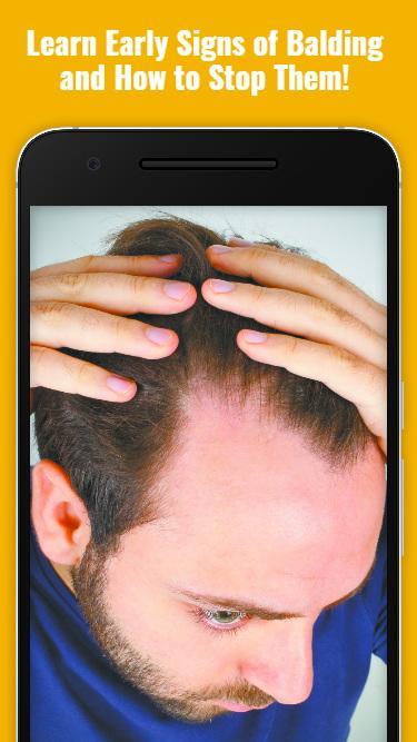How To Stop Baldness Thinning Hair Guide For Android Apk Download