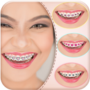 Decorate your Smile with Braces App APK
