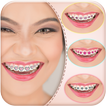 Decorate your Smile with Braces App