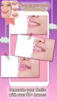 Decorate your Smile with Braces App screenshot 3